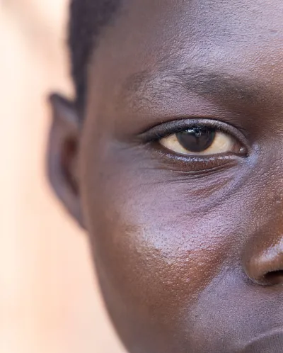 Nærbilde av Meyia fra Malawi.