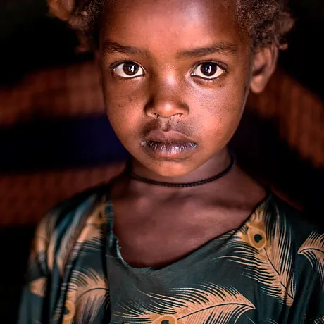 Sult i Etiopia