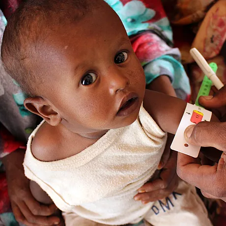 Baby som serp på mot kamera, blir målt rundt armen i helsesjekk