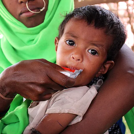 Ibrahim på syv måneder fra Sudan lider av alvorlig underernæring.